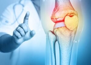 Doctor check and diagnose the Pain in knee joint on medical background. 3d illustration
