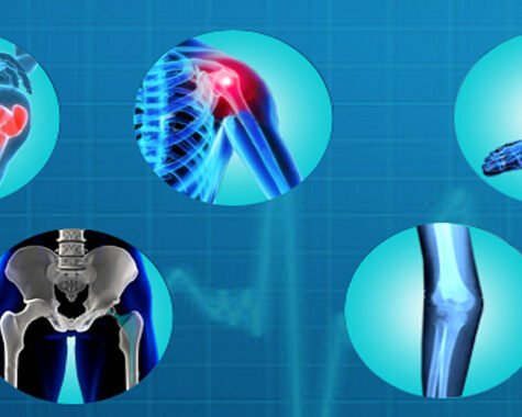 orthopedic-1